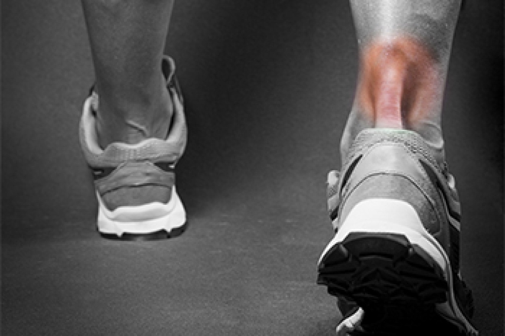 Abnormal Gait Patterns Can Lead to Achilles Tendon Injuries