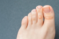 What Are the Common Causes of Corns on the Feet?