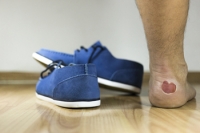 Ways to Help Prevent Blisters From Forming