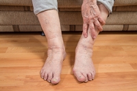 Foot Structure and Skin May Change in Elderly Feet