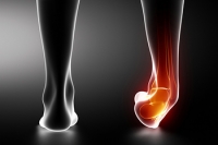 The Importance of Diagnosing an Ankle Sprain