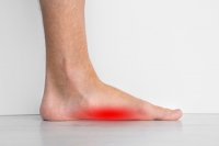 Surgery Options for Flat Feet